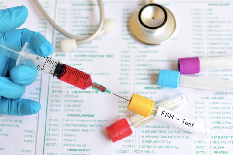 FSH Ménopause information, témoignage, symptômes, traitement